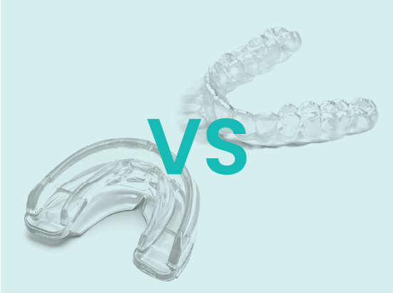 Clear aligners Vs Mouth guards